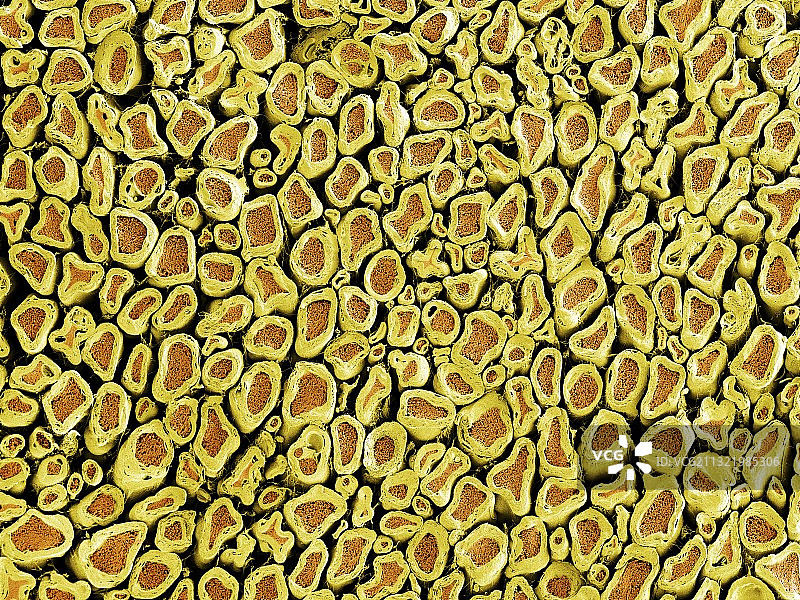 有髓神经，扫描电镜图片素材