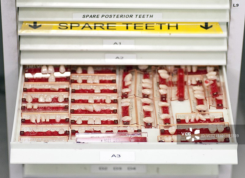 牙科贴面图片素材