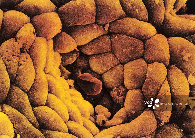 胃壁细胞扫描电镜图图片素材