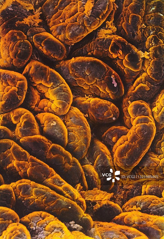 肠道内壁扫描电镜图图片素材