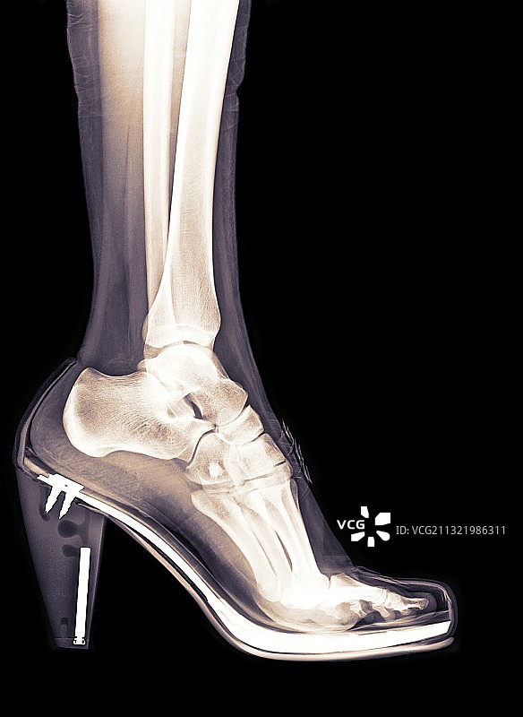 高跟鞋X光图片素材