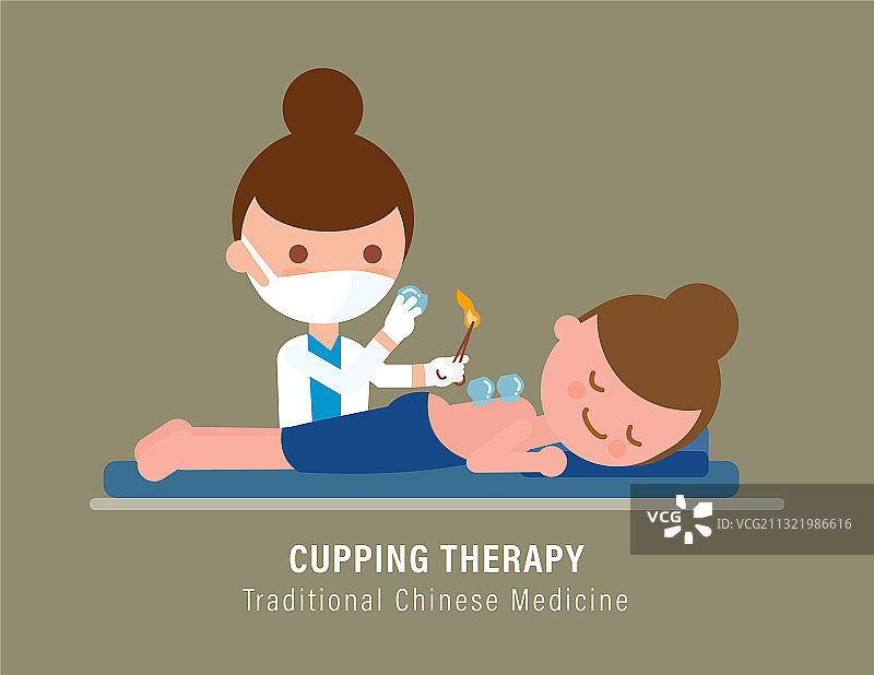 中医传统疗法：拔罐图片素材