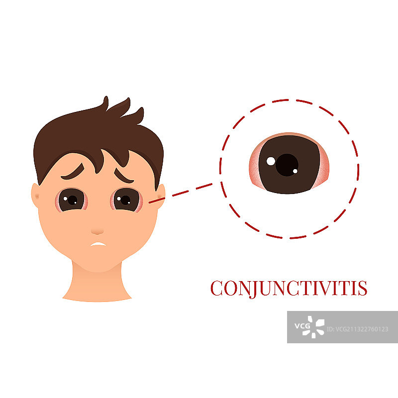 患有结膜炎的男人图片素材