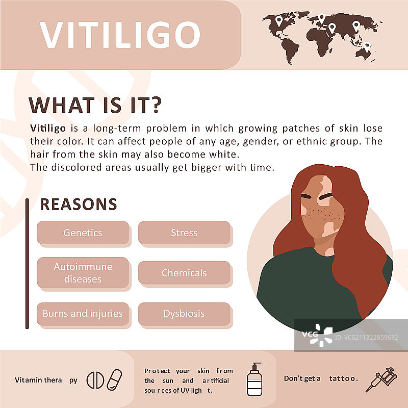 白癜风病因信息图图片素材