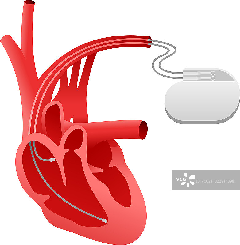 起搏器心脏刺激器图标图片素材