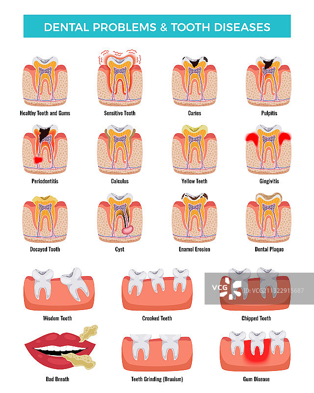 牙科疾病问题信息图图片素材