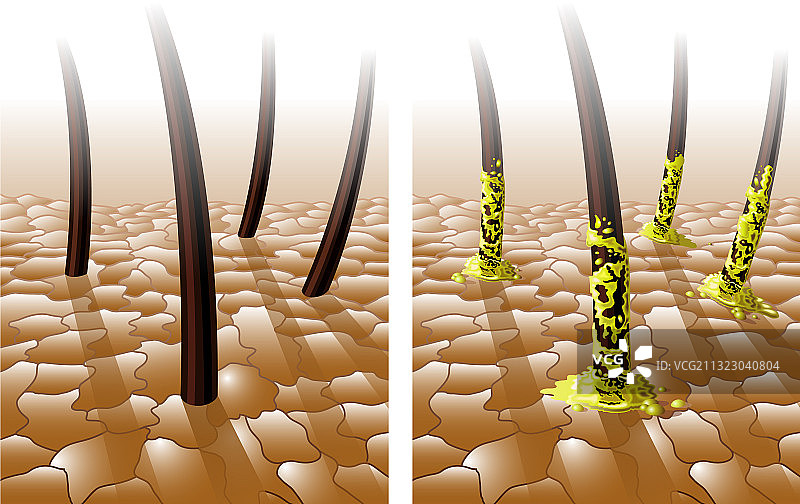 中性和油性头发图片素材