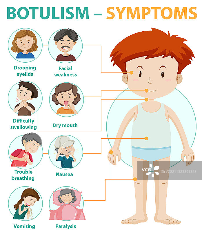 肉毒杆菌中毒症状信息图图片素材
