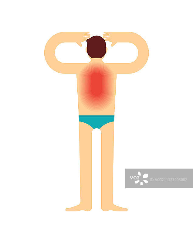 晒伤的男性背部图片素材