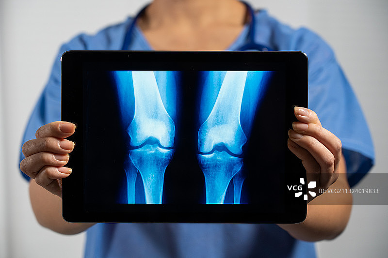 女医生拿着一张显示肺部X光片的屏幕图片素材
