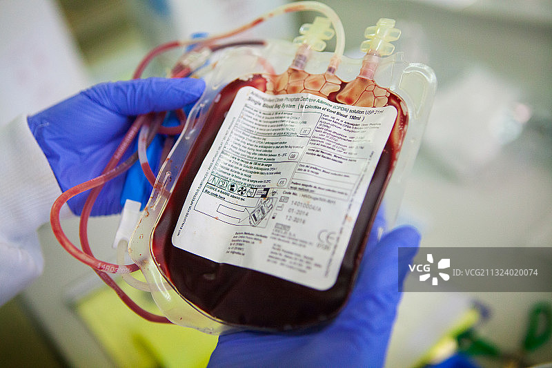 生物样本库：含脐带血干细胞（造血干细胞）的袋子图片素材