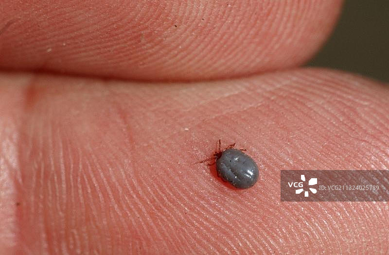 人皮肤上的蜱虫，德国下萨克森图片素材