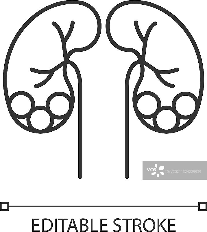 肾结石疾病线性图标图片素材
