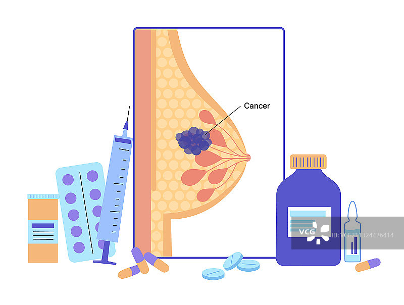 乳腺疾病概念图片素材