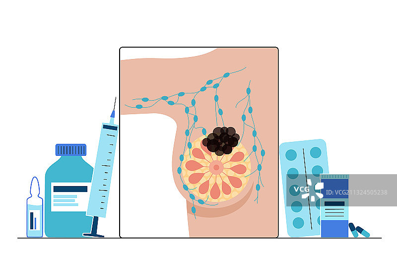 乳腺疾病概念图片素材