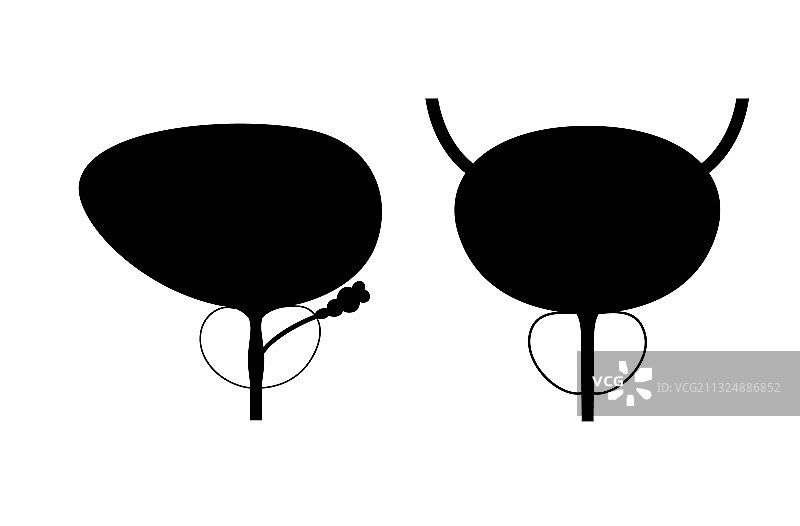 前列腺炎炎症问题图片素材