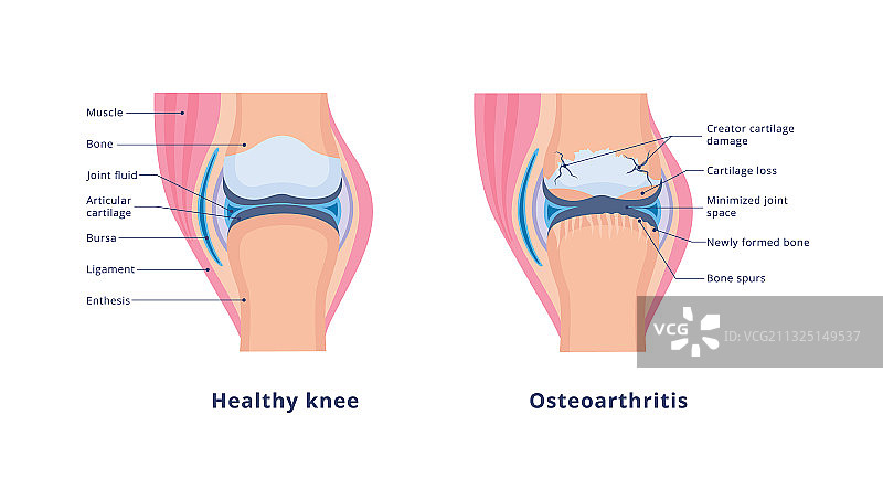 膝盖医疗解剖banner图片素材