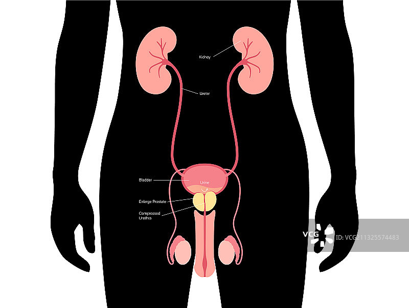 BPH信息概念图片素材