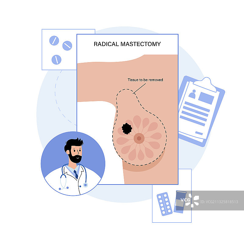 乳腺疾病概念图片素材