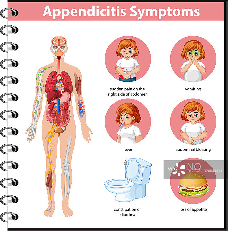阑尾炎症状信息图图片素材