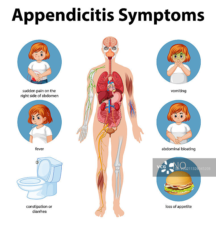 阑尾炎症状信息图图片素材