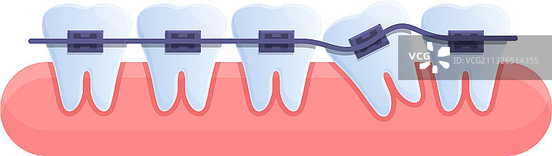 牙齿矫正美容卡通图标图片素材