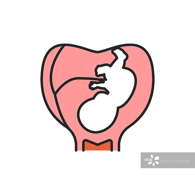 妊娠期子宫内带有脐带的胚胎图片素材