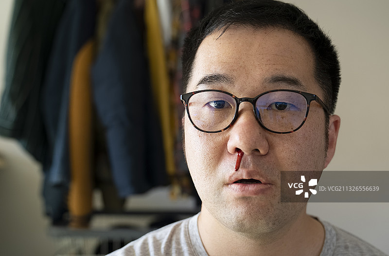 流鼻血的中年男人图片素材