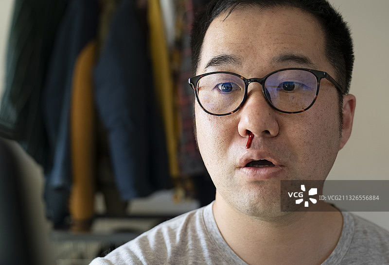 流鼻血的中年男人图片素材