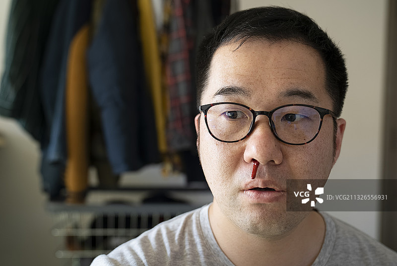 流鼻血的中年男人图片素材