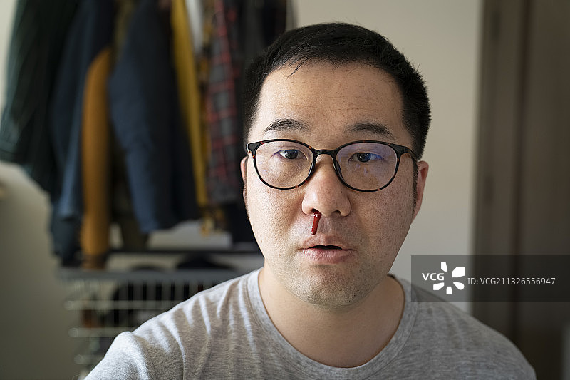 流鼻血的中年男人图片素材