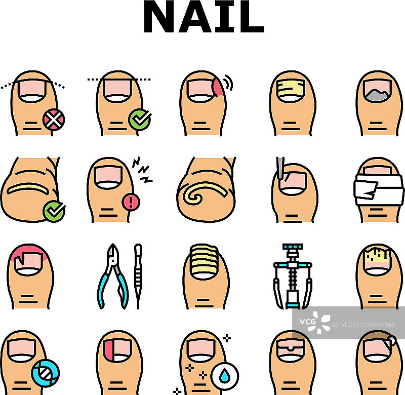 嵌甲疾病图标合集图片素材