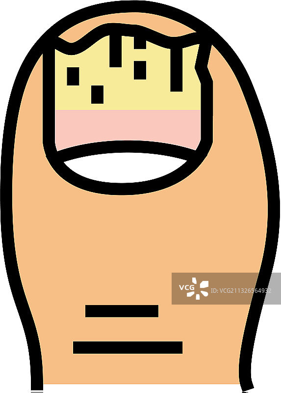 甲癣指甲疾病彩色图标图片素材