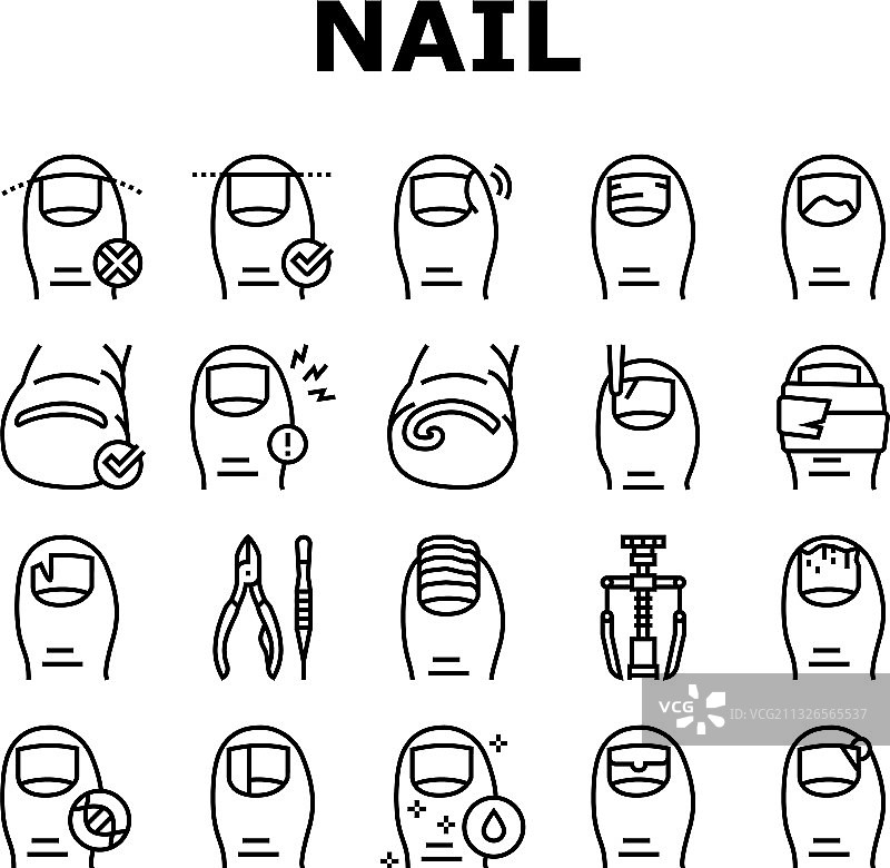 嵌甲疾病图标合集图片素材