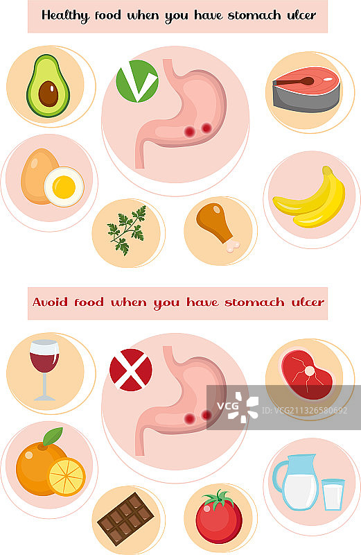 如果您有胃溃疡，应保持健康并避免某些食物图片素材