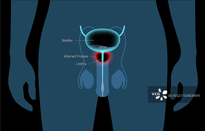 正常骨骼概念图片素材