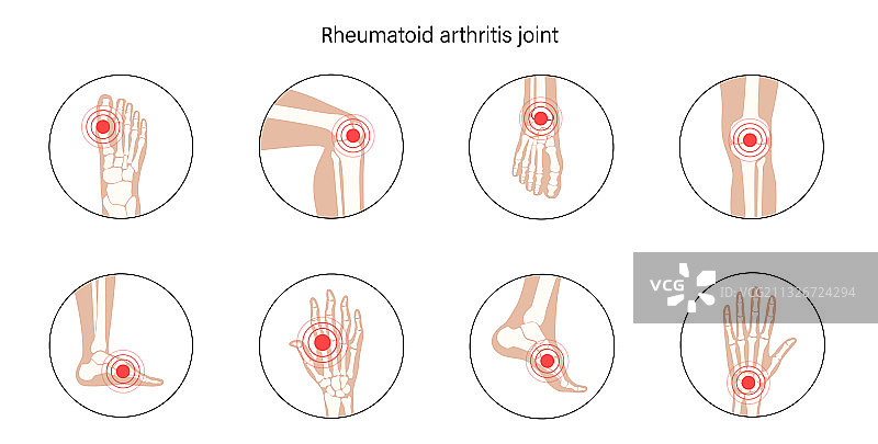 正常骨骼概念图片素材