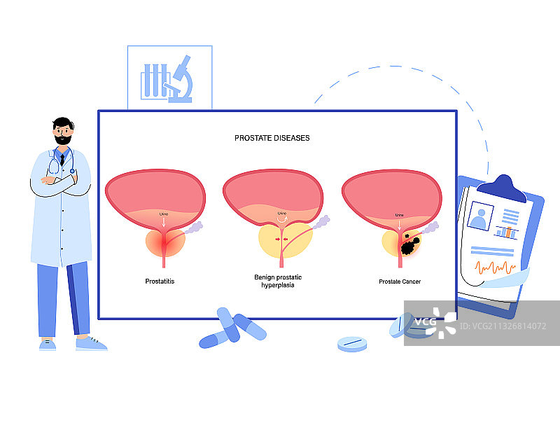 男性生殖系统问题图片素材