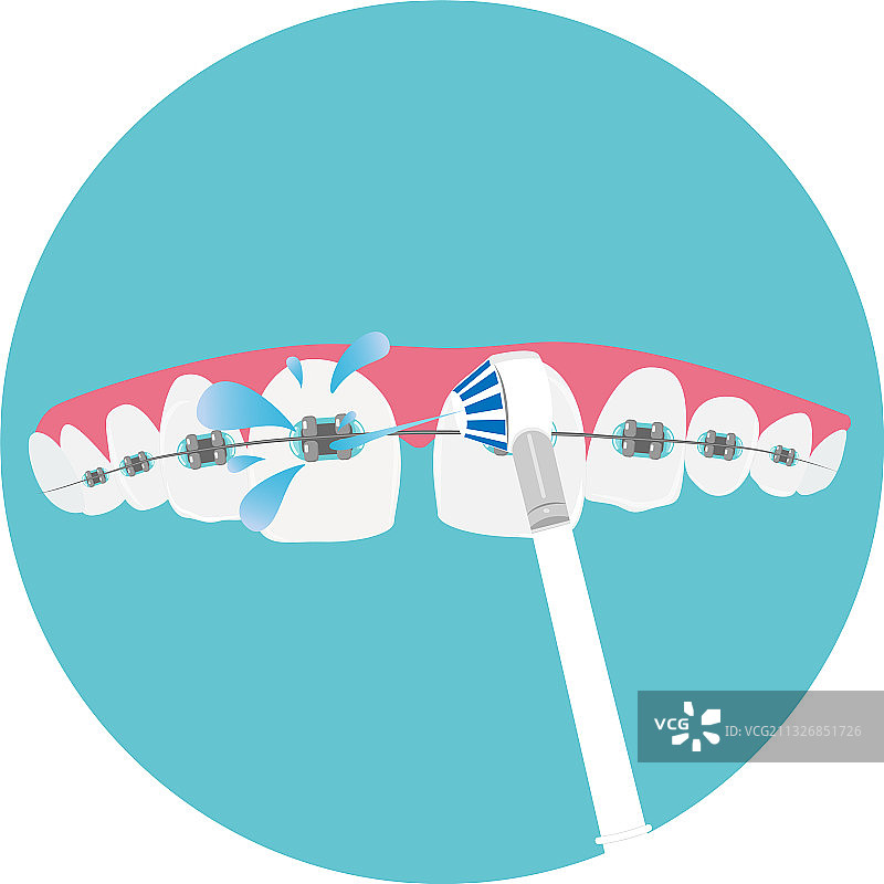 日常牙套口腔护理图片素材