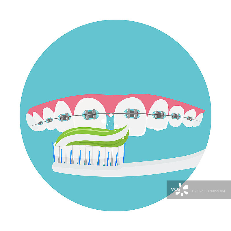 日常牙套口腔护理图片素材