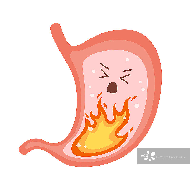 人类胃部着火：胃灼热和胃炎图片素材