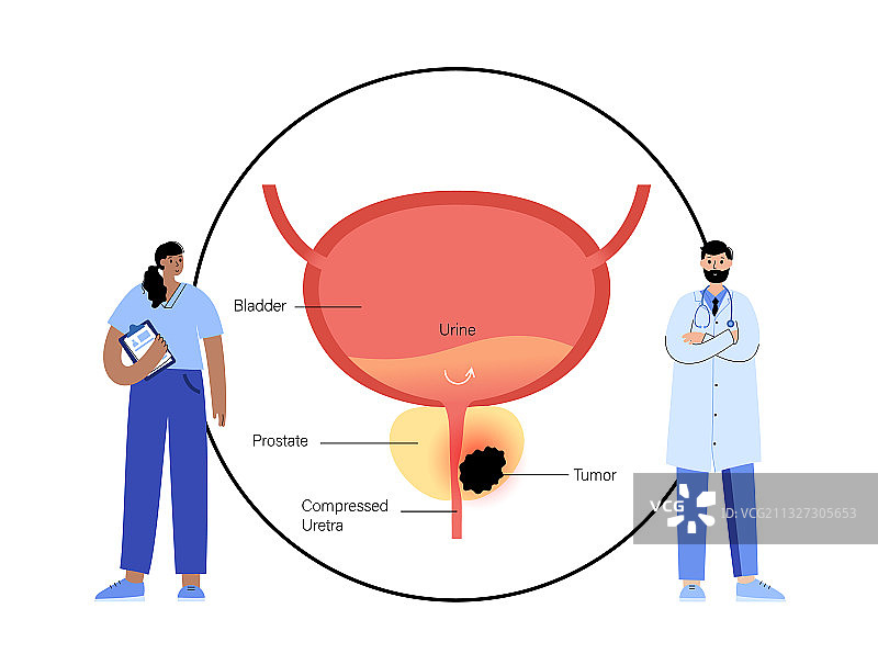 男性生殖系统问题图片素材