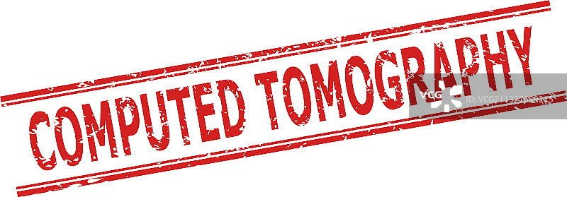 不清晰风格的CT扫描水印图片素材