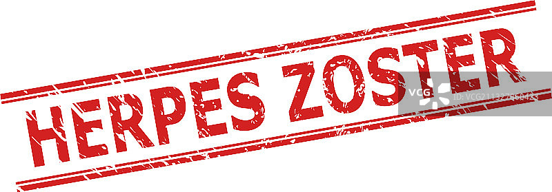 带颗粒表面的带状疱疹印章图片素材