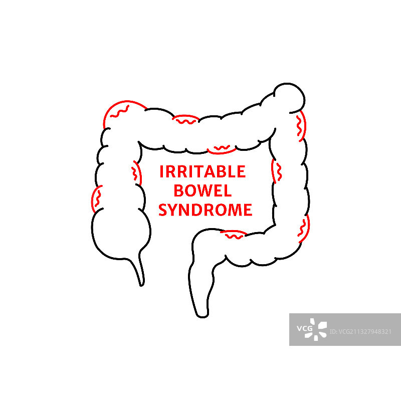 线性肠易激综合征标志图片素材
