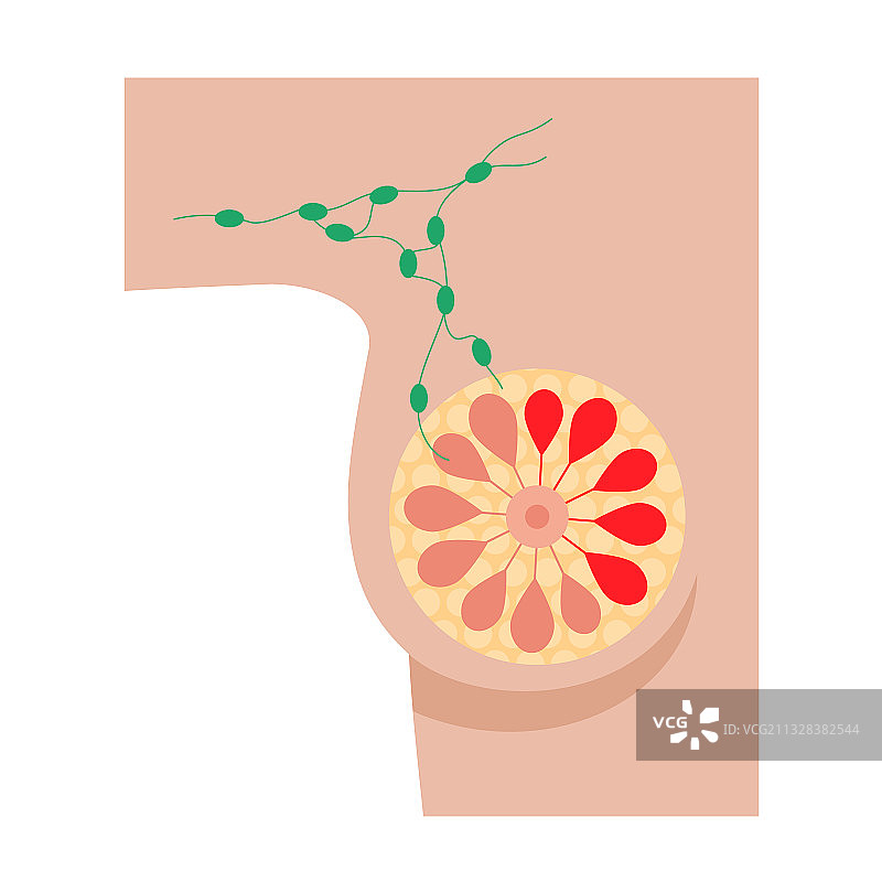乳腺疾病概念图片素材