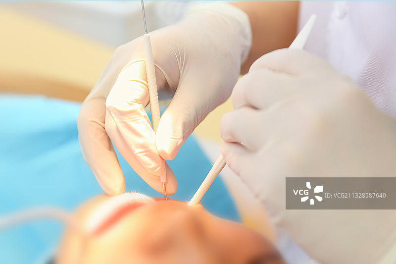 口腔治疗图片素材