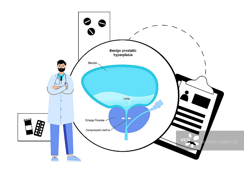 男性生殖系统问题图片素材