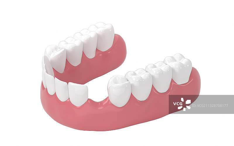有缺牙的口腔 3D渲染图片素材