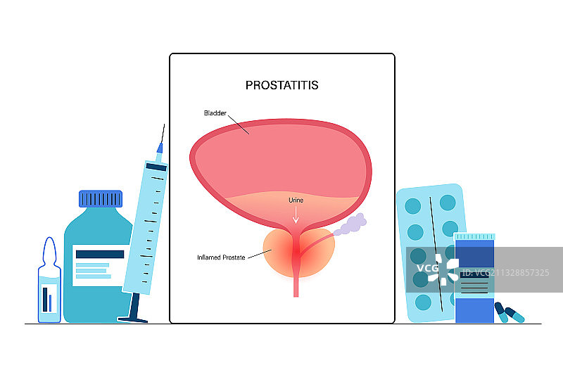 男性生殖系统问题图片素材